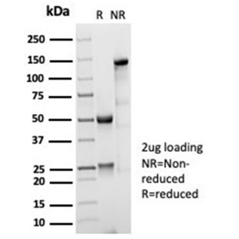 SDS-PAGE - Anti-CD35 Antibody [CR1/7016R] - BSA and Azide free (A278551) - Antibodies.com