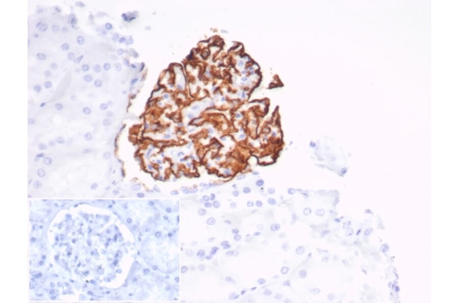 Immunohistochemistry - Anti-CD35 Antibody [CR1/7016R] - BSA and Azide free (A278551) - Antibodies.com