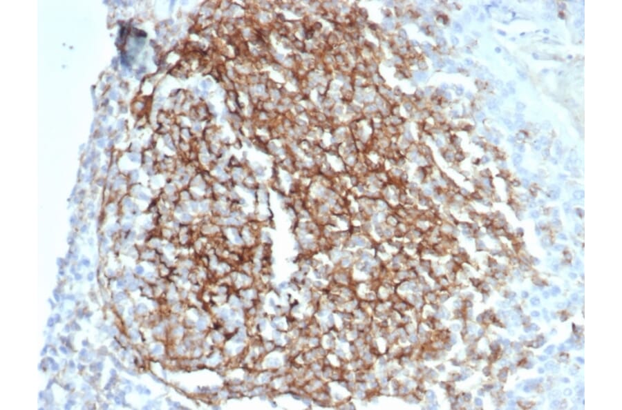 Immunohistochemistry - Anti-CD35 Antibody [CR1/7016R] - BSA and Azide free (A278551) - Antibodies.com