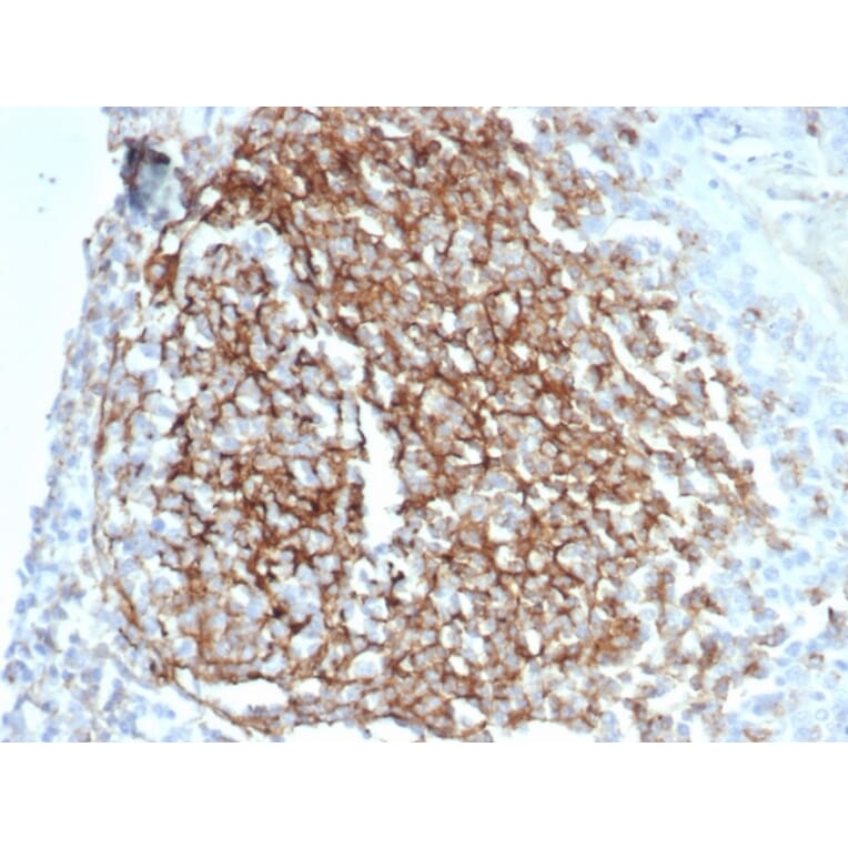 Immunohistochemistry - Anti-CD35 Antibody [CR1/7016R] - BSA and Azide free (A278551) - Antibodies.com