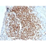Immunohistochemistry - Anti-CD35 Antibody [CR1/7016R] - BSA and Azide free (A278551) - Antibodies.com