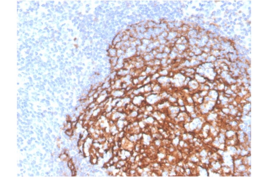 Immunohistochemistry - Anti-CD21 Antibody [CR2/3990R] - BSA and Azide free (A278552) - Antibodies.com