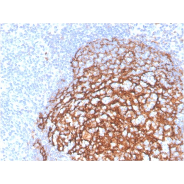Immunohistochemistry - Anti-CD21 Antibody [CR2/3990R] - BSA and Azide free (A278552) - Antibodies.com