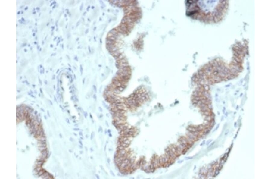 Immunohistochemistry - Anti-beta Catenin Antibody [CTNNB1/7044R] - BSA and Azide free (A278556) - Antibodies.com
