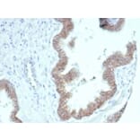 Immunohistochemistry - Anti-beta Catenin Antibody [CTNNB1/7044R] - BSA and Azide free (A278556) - Antibodies.com