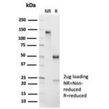 SDS-PAGE - Anti-beta Catenin Antibody [CTNNB1/7044R] - BSA and Azide free (A278556) - Antibodies.com
