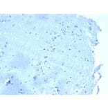 Immunohistochemistry - Anti-delta 1 Catenin Antibody [CTNND1/4383R] - BSA and Azide free (A278557) - Antibodies.com