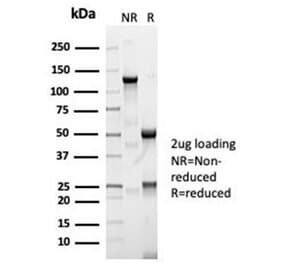 SDS-PAGE - Anti-Angiotensin Converting Enzyme 1 Antibody [ACE/7004R] - BSA and Azide free (A278559) - Antibodies.com