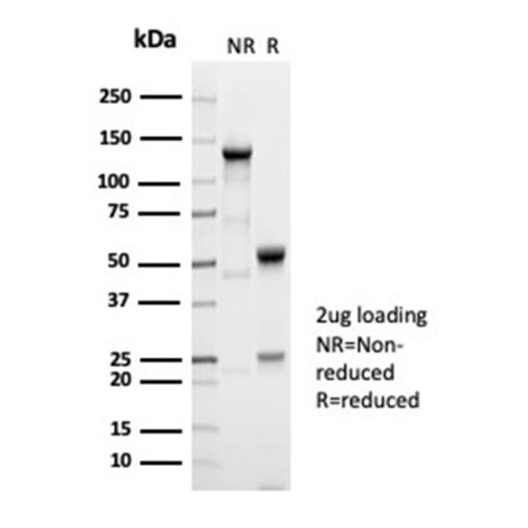 SDS-PAGE - Anti-alpha Fetoprotein Antibody [AFP/7007R] - BSA and Azide free (A278560) - Antibodies.com