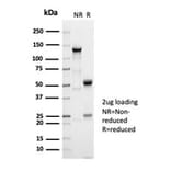 SDS-PAGE - Anti-alpha Fetoprotein Antibody [AFP/7007R] - BSA and Azide free (A278560) - Antibodies.com