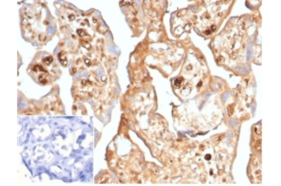 Immunohistochemistry - Anti-alpha Fetoprotein Antibody [AFP/7007R] - BSA and Azide free (A278560) - Antibodies.com