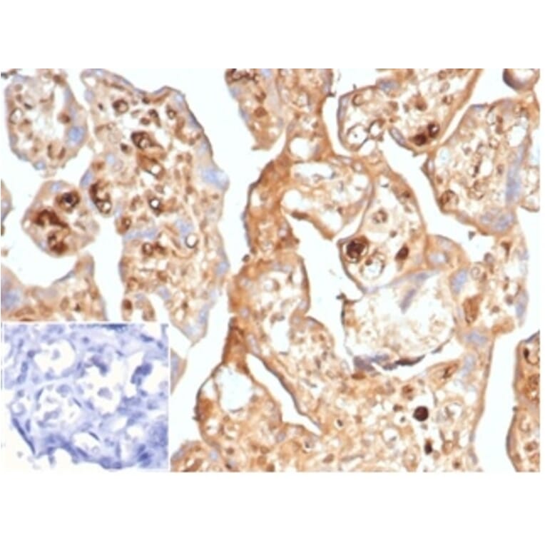 Immunohistochemistry - Anti-alpha Fetoprotein Antibody [AFP/7007R] - BSA and Azide free (A278560) - Antibodies.com