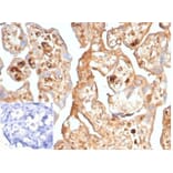 Immunohistochemistry - Anti-alpha Fetoprotein Antibody [AFP/7007R] - BSA and Azide free (A278560) - Antibodies.com