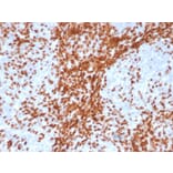 Immunohistochemistry - Anti-TdT Antibody [DNTT/4617R] - BSA and Azide free (A278561) - Antibodies.com