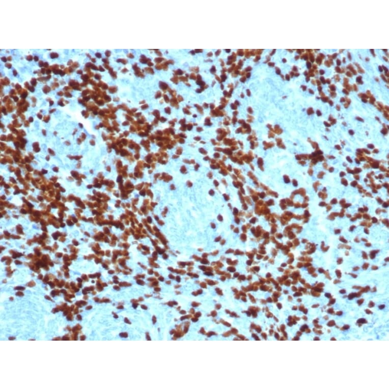 Immunohistochemistry - Anti-TdT Antibody [DNTT/4617R] - BSA and Azide free (A278561) - Antibodies.com