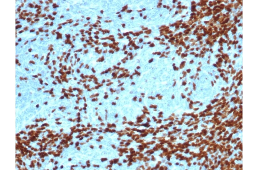 Immunohistochemistry - Anti-TdT Antibody [DNTT/4617R] - BSA and Azide free (A278561) - Antibodies.com