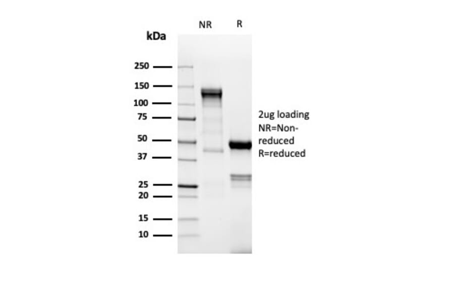 SDS-PAGE - Anti-TdT Antibody [DNTT/4617R] - BSA and Azide free (A278561) - Antibodies.com