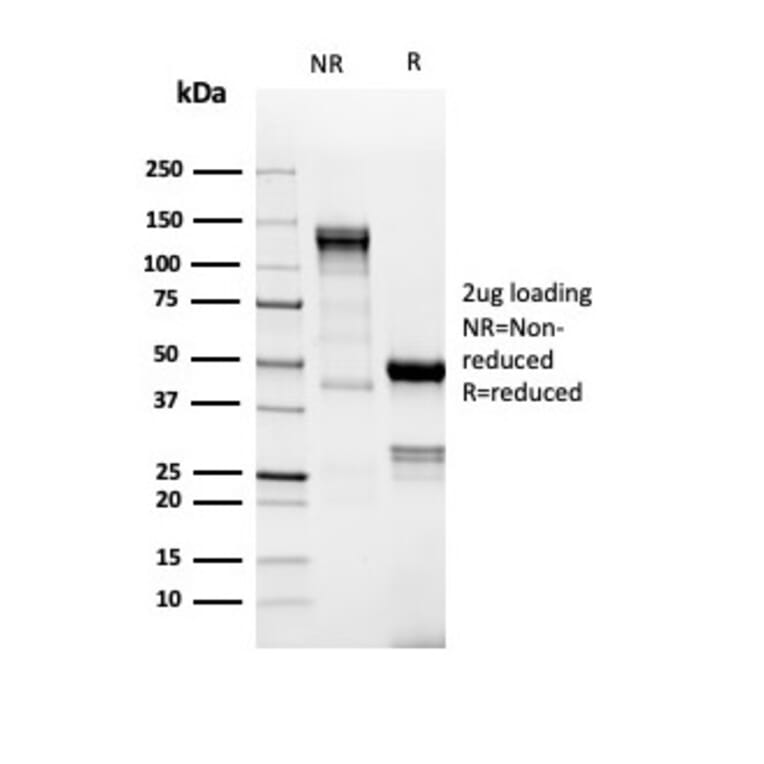 SDS-PAGE - Anti-TdT Antibody [DNTT/4617R] - BSA and Azide free (A278561) - Antibodies.com