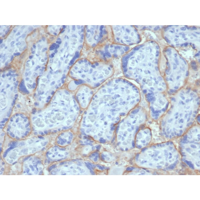 Immunohistochemistry - Anti-EGFR Antibody [EGFR/6390R] - BSA and Azide free (A278562) - Antibodies.com