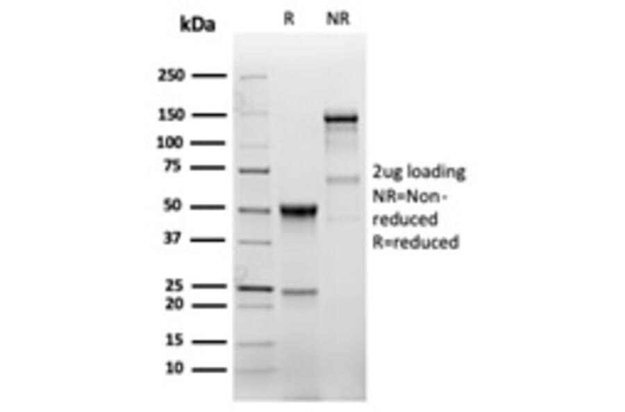 SDS-PAGE - Anti-EGFR Antibody [EGFR/6390R] - BSA and Azide free (A278562) - Antibodies.com