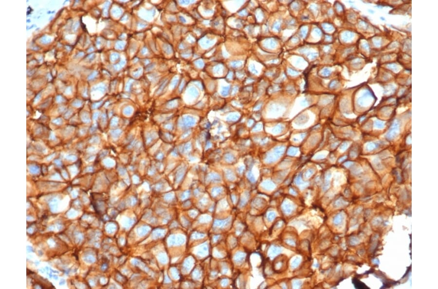 Immunohistochemistry - Anti-HER2 Antibody [ERBB2/4376R] - BSA and Azide free (A278563) - Antibodies.com