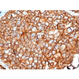 Immunohistochemistry - Anti-HER2 Antibody [ERBB2/4376R] - BSA and Azide free (A278563) - Antibodies.com