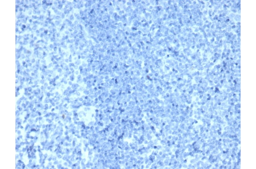 Immunohistochemistry - Anti-HER2 Antibody [ERBB2/4376R] - BSA and Azide free (A278563) - Antibodies.com