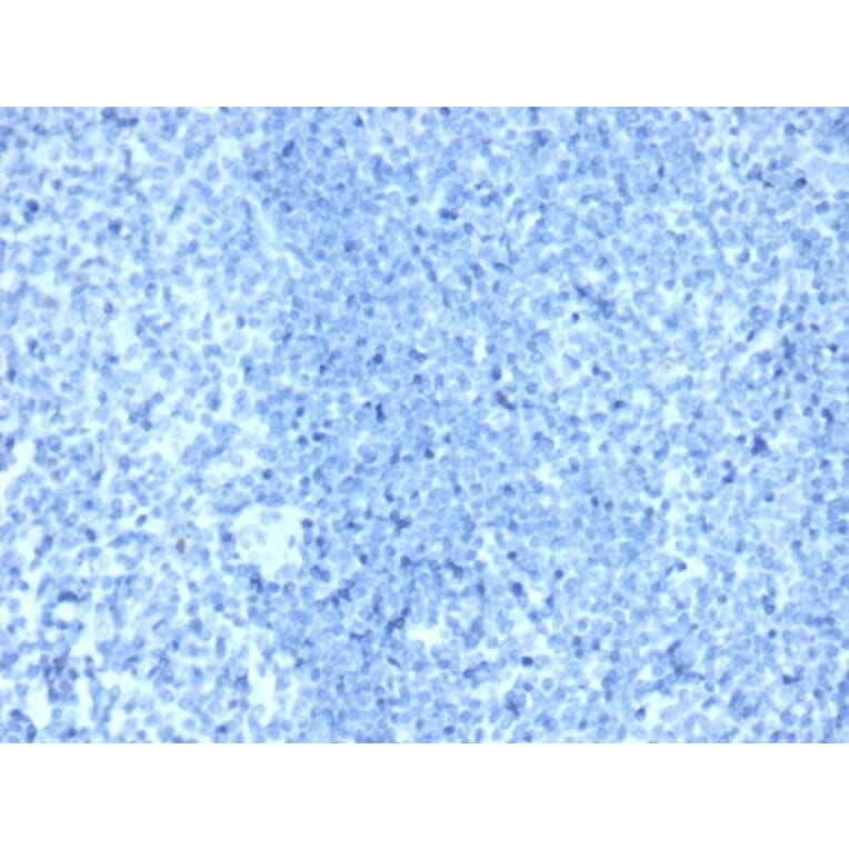 Immunohistochemistry - Anti-HER2 Antibody [ERBB2/4376R] - BSA and Azide free (A278563) - Antibodies.com