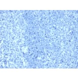 Immunohistochemistry - Anti-HER2 Antibody [ERBB2/4376R] - BSA and Azide free (A278563) - Antibodies.com