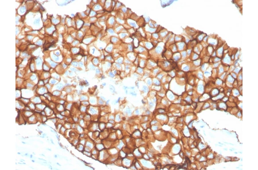 Immunohistochemistry - Anti-HER2 Antibody [ERBB2/4376R] - BSA and Azide free (A278563) - Antibodies.com