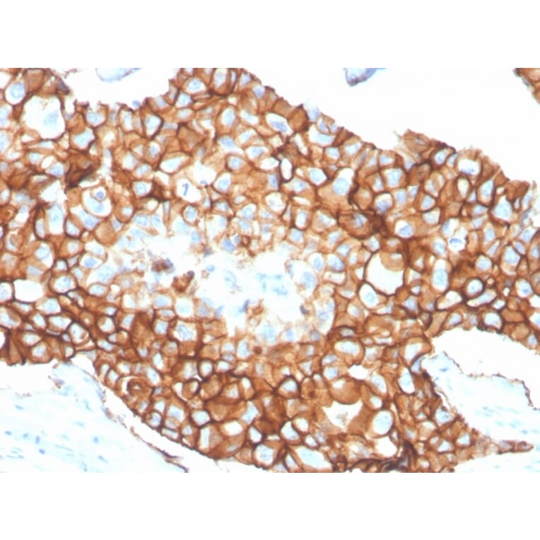 Immunohistochemistry - Anti-HER2 Antibody [ERBB2/4376R] - BSA and Azide free (A278563) - Antibodies.com