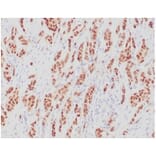 Immunohistochemistry - Anti-Estrogen Receptor alpha Antibody [ESR1/4039R] - BSA and Azide free (A278564) - Antibodies.com