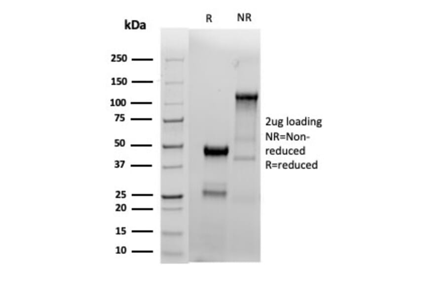 SDS-PAGE - Anti-Estrogen Receptor alpha Antibody [ESR1/4039R] - BSA and Azide free (A278564) - Antibodies.com