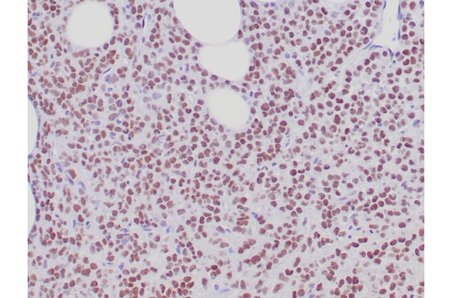 Immunohistochemistry - Anti-Estrogen Receptor alpha Antibody [ESR1/6811R] - BSA and Azide free (A278565) - Antibodies.com