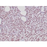 Immunohistochemistry - Anti-Estrogen Receptor alpha Antibody [ESR1/6811R] - BSA and Azide free (A278565) - Antibodies.com