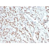 Immunohistochemistry - Anti-Estrogen Receptor alpha Antibody [ESR1/6811R] - BSA and Azide free (A278565) - Antibodies.com