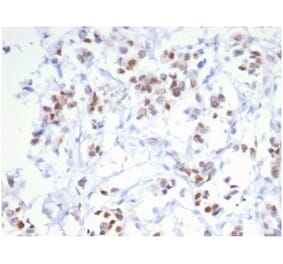 Immunohistochemistry - Anti-Estrogen Receptor alpha Antibody [ESR1/6983R] - BSA and Azide free (A278566) - Antibodies.com