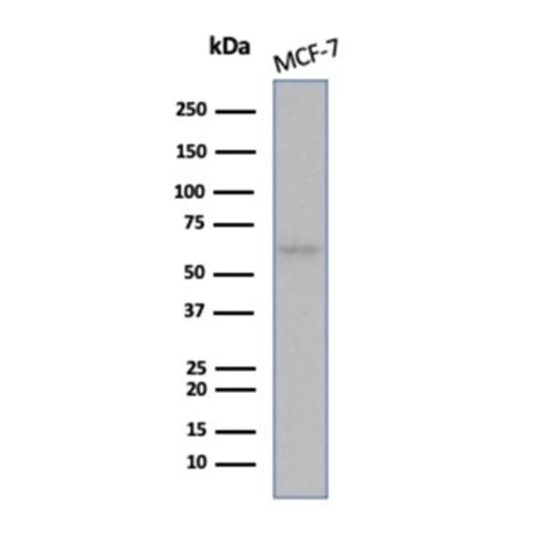 Western Blot - Anti-Estrogen Receptor alpha Antibody [ESR1/6983R] - BSA and Azide free (A278566) - Antibodies.com