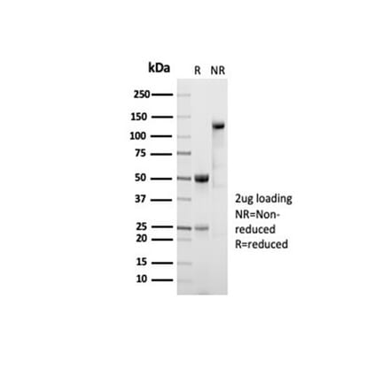 SDS-PAGE - Anti-ALDH1A1 Antibody [ALDH1A1/7011R] - BSA and Azide free (A278568) - Antibodies.com