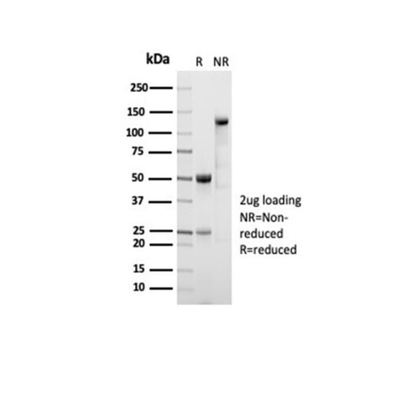 SDS-PAGE - Anti-ALDH1A1 Antibody [ALDH1A1/7011R] - BSA and Azide free (A278568) - Antibodies.com