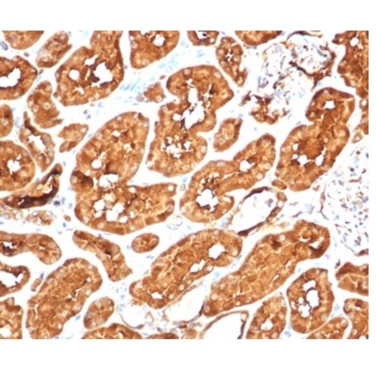 Immunohistochemistry - Anti-ALDH1A1 Antibody [ALDH1A1/7011R] - BSA and Azide free (A278568) - Antibodies.com
