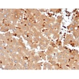 Immunohistochemistry - Anti-FABP5 Antibody [FABP5/6353R] - BSA and Azide free (A278569) - Antibodies.com