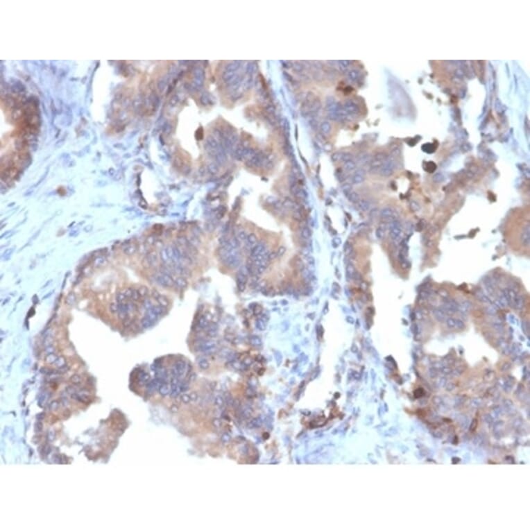 Immunohistochemistry - Anti-FABP5 Antibody [FABP5/6353R] - BSA and Azide free (A278569) - Antibodies.com