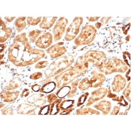 Immunohistochemistry - Anti-AKR1B1 Antibody [AKR1B1/7010R] - BSA and Azide free (A278571) - Antibodies.com