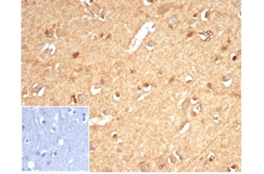 Immunohistochemistry - Anti-AKR1B1 Antibody [AKR1B1/7010R] - BSA and Azide free (A278571) - Antibodies.com