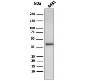 Western Blot - Anti-Filaggrin Antibody [FLG/3909R] - BSA and Azide free (A278572) - Antibodies.com