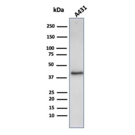 Western Blot - Anti-Filaggrin Antibody [FLG/3909R] - BSA and Azide free (A278572) - Antibodies.com