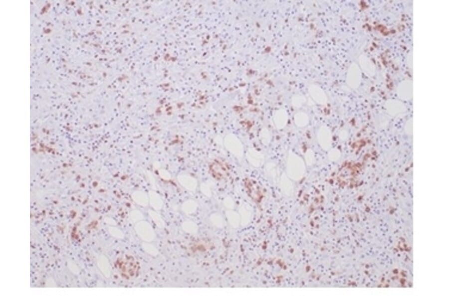 Immunohistochemistry - Anti-ALK Antibody [ALK1/7008R] - BSA and Azide free (A278574) - Antibodies.com