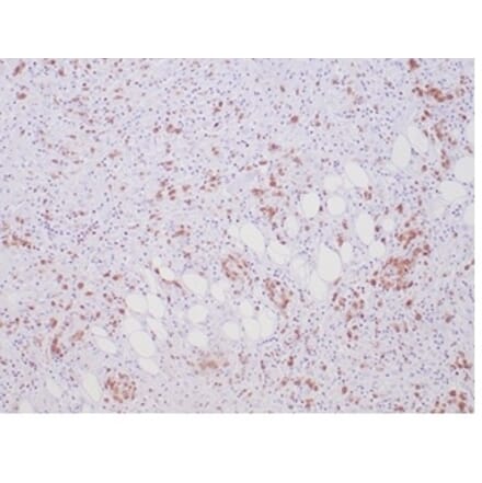 Immunohistochemistry - Anti-ALK Antibody [ALK1/7008R] - BSA and Azide free (A278574) - Antibodies.com