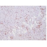 Immunohistochemistry - Anti-ALK Antibody [ALK1/7008R] - BSA and Azide free (A278574) - Antibodies.com